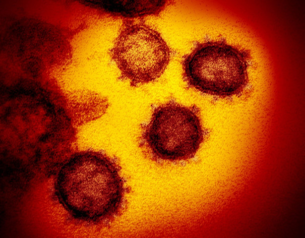 Światowa Organizacja Zdrowia (WHO) podniosła ocenę ryzyka związanego z koronawirusem z wysokiego do bardzo wysokiego na poziomie globalnym - powiedział w piątek dyrektor generalny WHO Tedros Adhanom Ghebreyesus. Na świecie trwają prace nad 20 szczepionkami - dodał.