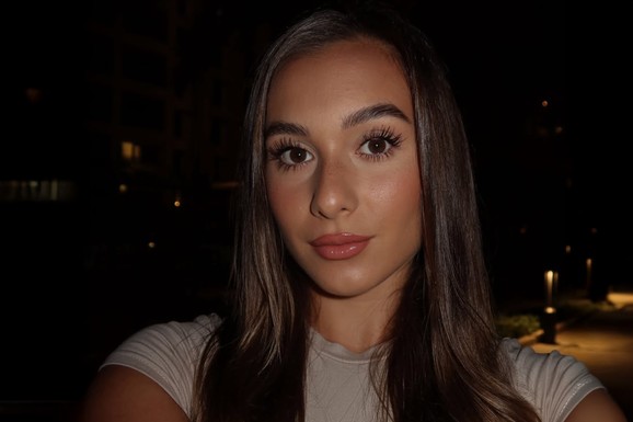 (FOTO) ĆERKA FLOMASTEROM ISCRTALA CELO TELO MAJCI Poznata Srpkinja pokazala kako izgleda u kupaćem, a po njoj svuda crvene linije i tačkice