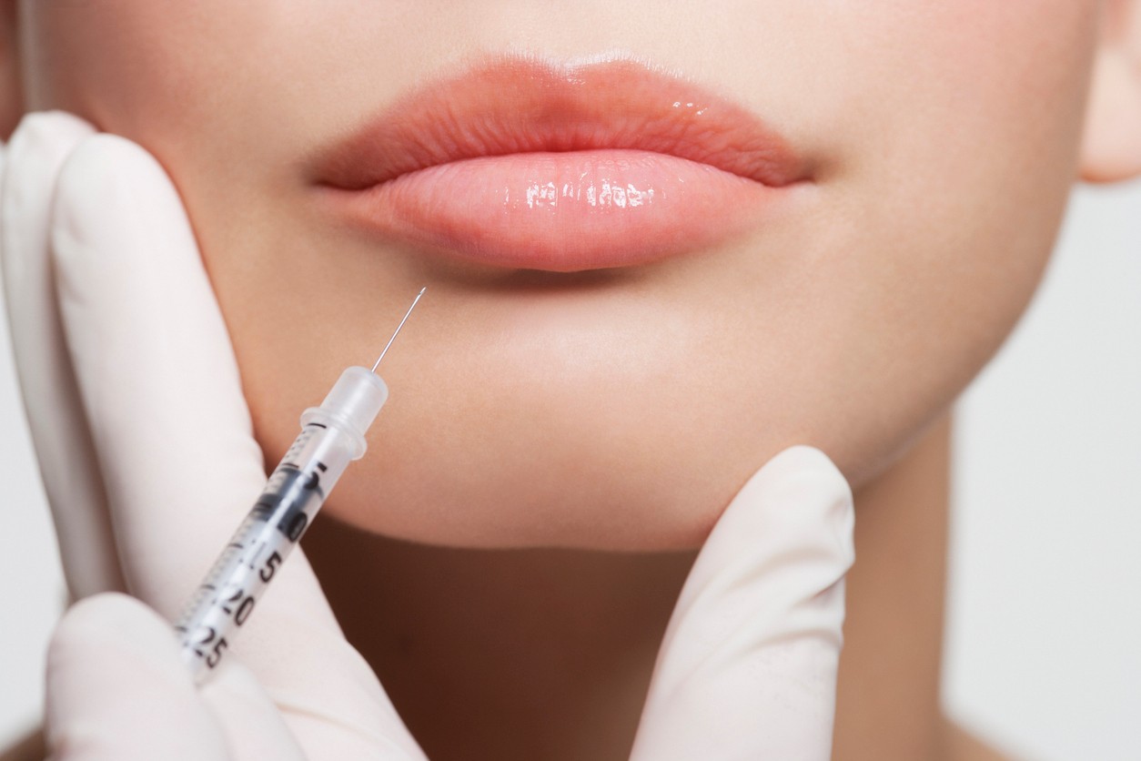 People like the natural lips more. (illustration photo)