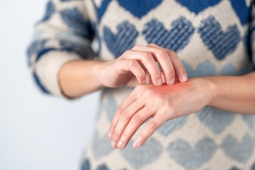 Ez az összefüggés a bőrgomba és a daganatok kialakulása között