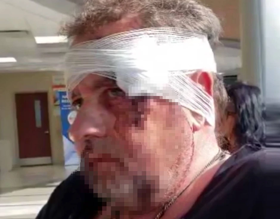 Pretučeni Vasilije Stanković