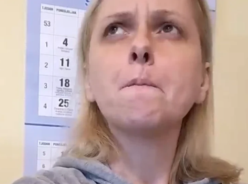 Od male bubuljice, do GLOMAZNOG TUMORA: Glumica (45) godinama prolazila agoniju, LEKARI JOJ UKLONILI ČETVRTINU USNE, a onda usledile NAJGORE VESTI! 