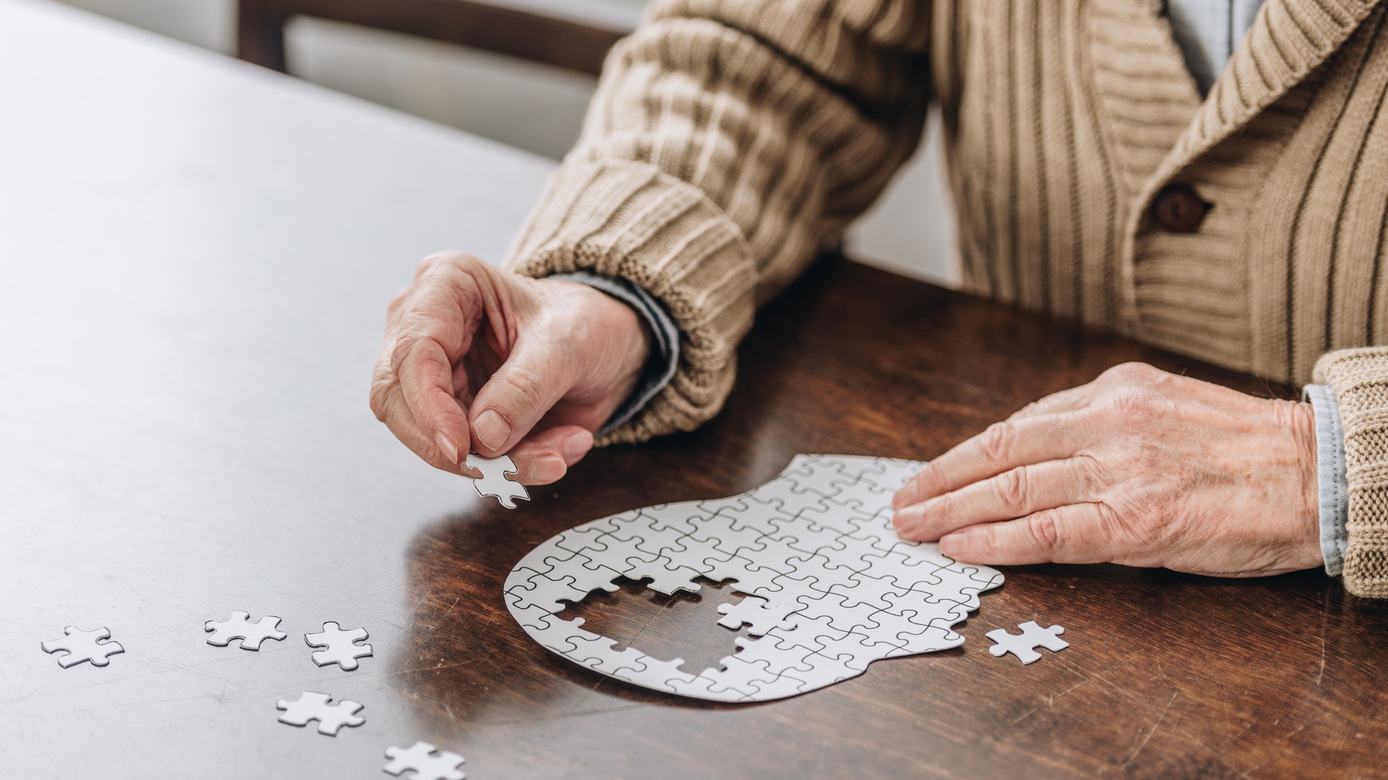 Alzheimerova choroba je neurodegeneratívne ochorenie mozgu. (ilustračné foto!