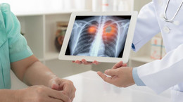 Leczenie zgagi przedłuża życie chorych na płuca