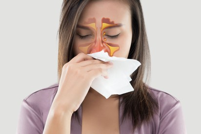 Visszatérő arcüreggyulladás: orrpolip és reflux is állhat a háttérben