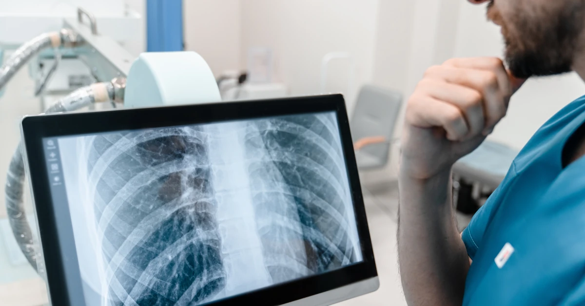 Gruźlica w krakowskim liceum. Ponad 100 osób znalazło się pod nadzorem epidemiologicznym