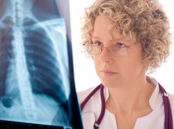 Rak płuc zbiera tragiczne żniwo. Wśród kobiet