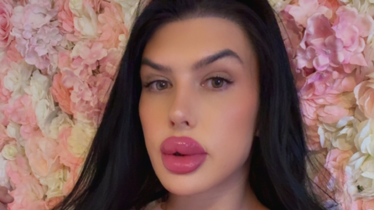 Sofia Lips má podľa vlastných slov najväčšie pery v Spojenom kráľovstve.