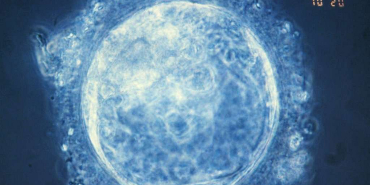 Stworzono pierwszy syntetyczny ludzki embrion. Zdjęcie ilustracyjne.