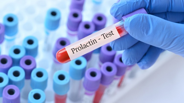 Prolaktin-hiány tünet vizsgálat kezelés