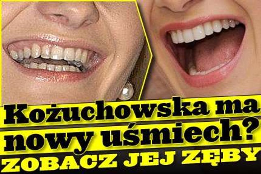 Kożuchowska ma nowy uśmiech? Zobacz jej zęby