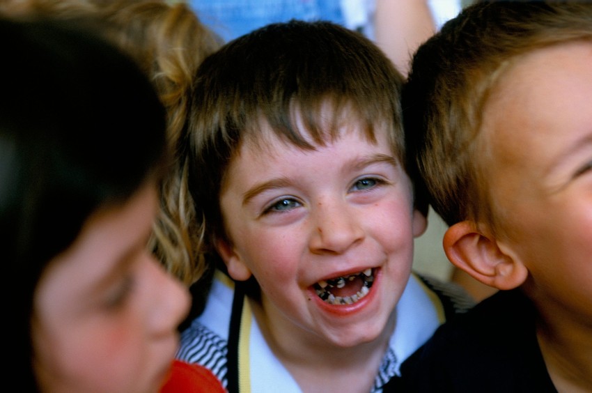 Loša higijena zuba i prekomerna konzumacija slatkiša dovela je do ovoga