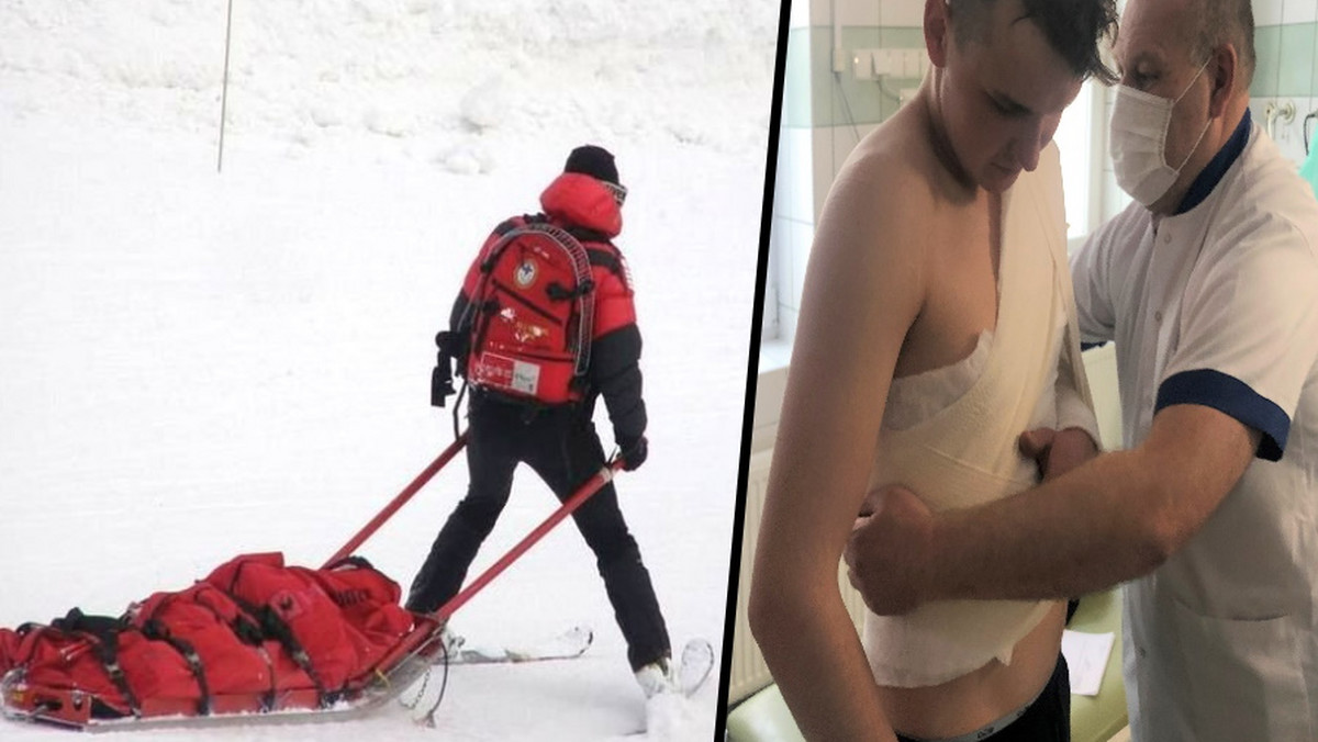 Setki połamanych narciarzy w zakopiańskim szpitalu. A będzie ich jeszcze więcej