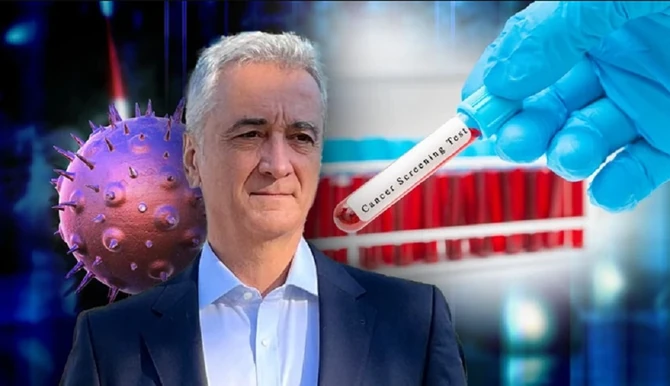 Čuveni profesor o raku debelog creva 