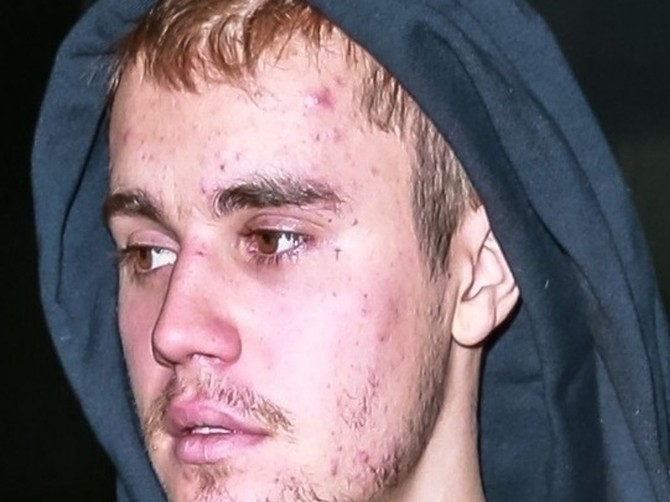 Džastin Biber progovorio o borbi sa zavisnošću