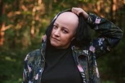 Autorka książki 'Alopecjanki': Łysa kobieta powoli przestaje być już 'babą z brodą'