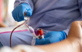 badania-krwi-pozwola-wykryc-raka-pecherzyka-zolciowego-co-to-za-nowotwor