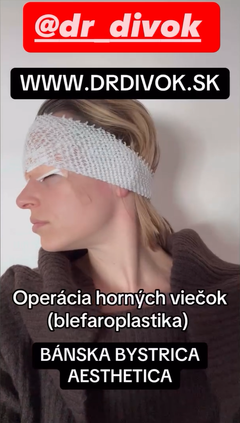 Romana Tabaková podstúpila operáciu horných viečok.
