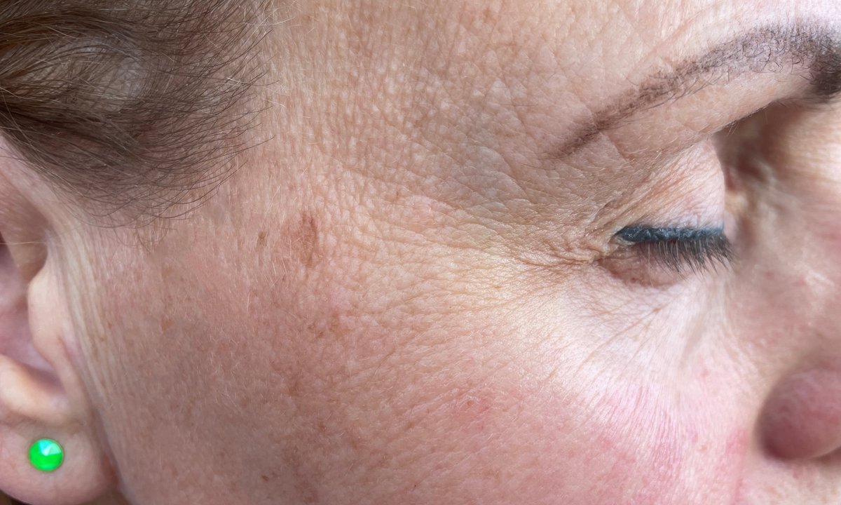 Dojrzałe panie wykupują ten "rozjaśniacz przebarwień"! Plamki starcze nie mają szans