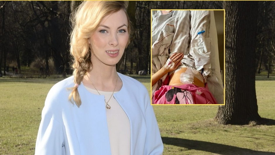 Karolina Giniecka w 2015 r. fot. w miniaturce: Karolinia Gliniecka po operacji, screen: instagram.com/charlizemystery