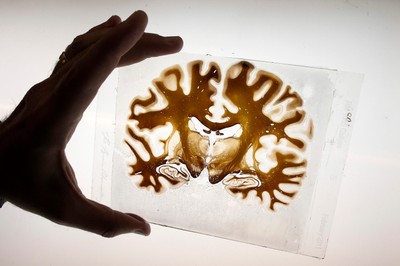 'FT': Odwet świata drobnoustrojów - nauka jest bezbronna