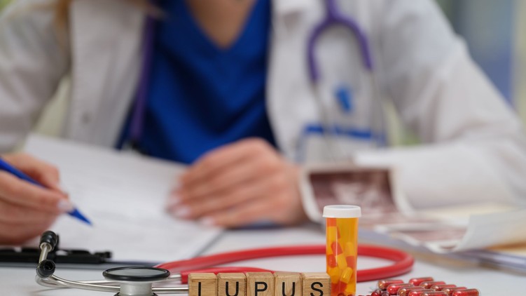 lupus tünet diagnózis arcpír ízületi fájdalom