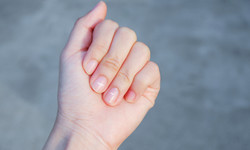 Co wygląd paznokci zdradza o twoim zdrowiu?