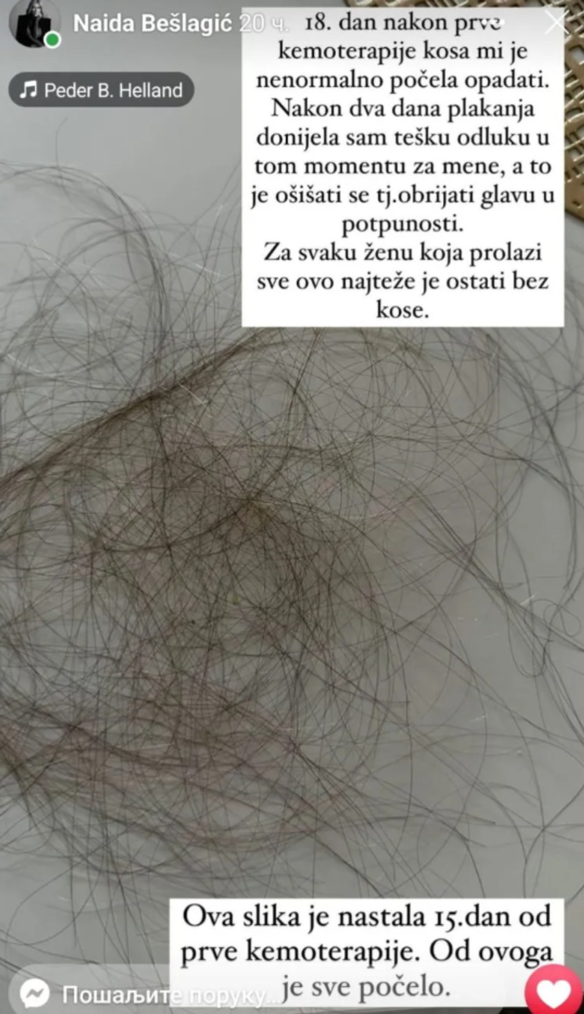 Naida Bešlagić o borbi sa rakom