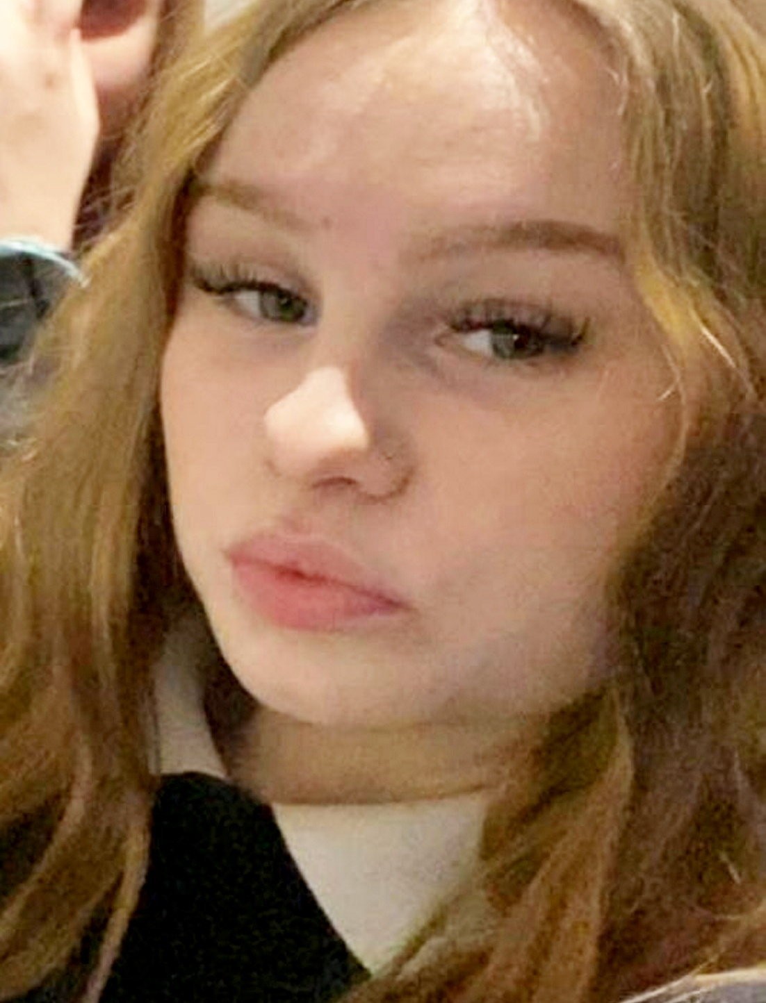 Shakira Gorman bojuje o život po tom, čo utrpela mimoriadne zriedkavú mozgovú príhodu.