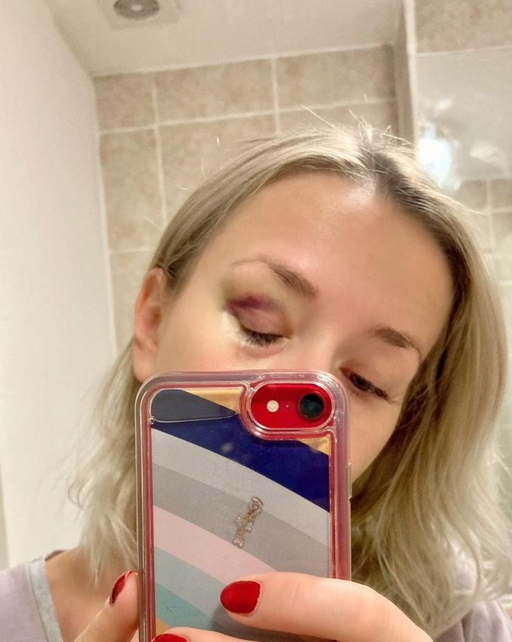 Alicja Faryniarz teraz šíri osvetu o AVM.