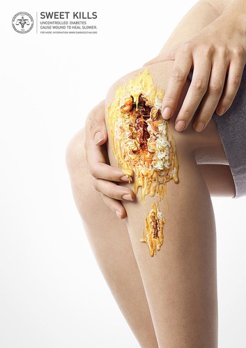 'SŁODYCZ ZABIJA'. KAMPANIA PRZECIWKO CUKRZYCY