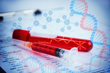 vérkép, vérkép eltérések, laboreredmény, heamotológus, hemoglobin, vérszegénység, anémia