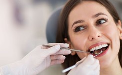 To musisz wiedzieć, zanim zdecydujesz się na licówki na zęby