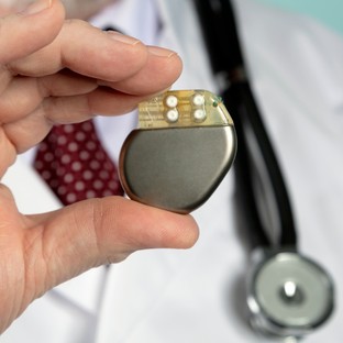 Mi a pacemaker beültetés?