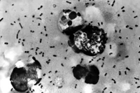 Epidemia dżumy w Rosji? Pierwszy śmiertelny przypadek na Syberii
