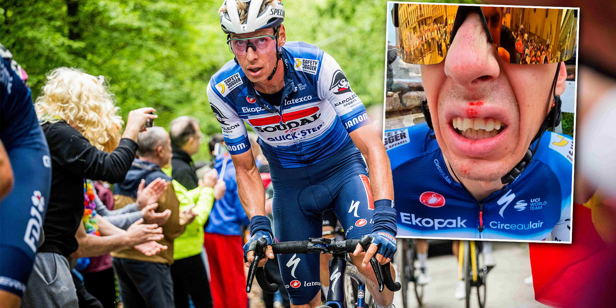 Jan Hirt przed etapem Tour de France złamał trzy zęby. 