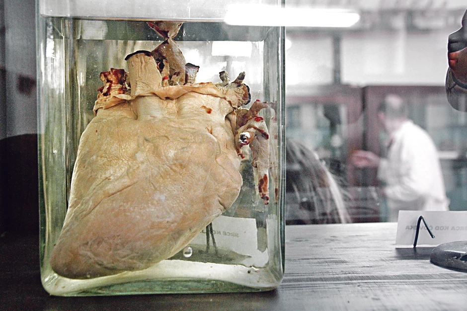 Životinjsko srce u formalinu