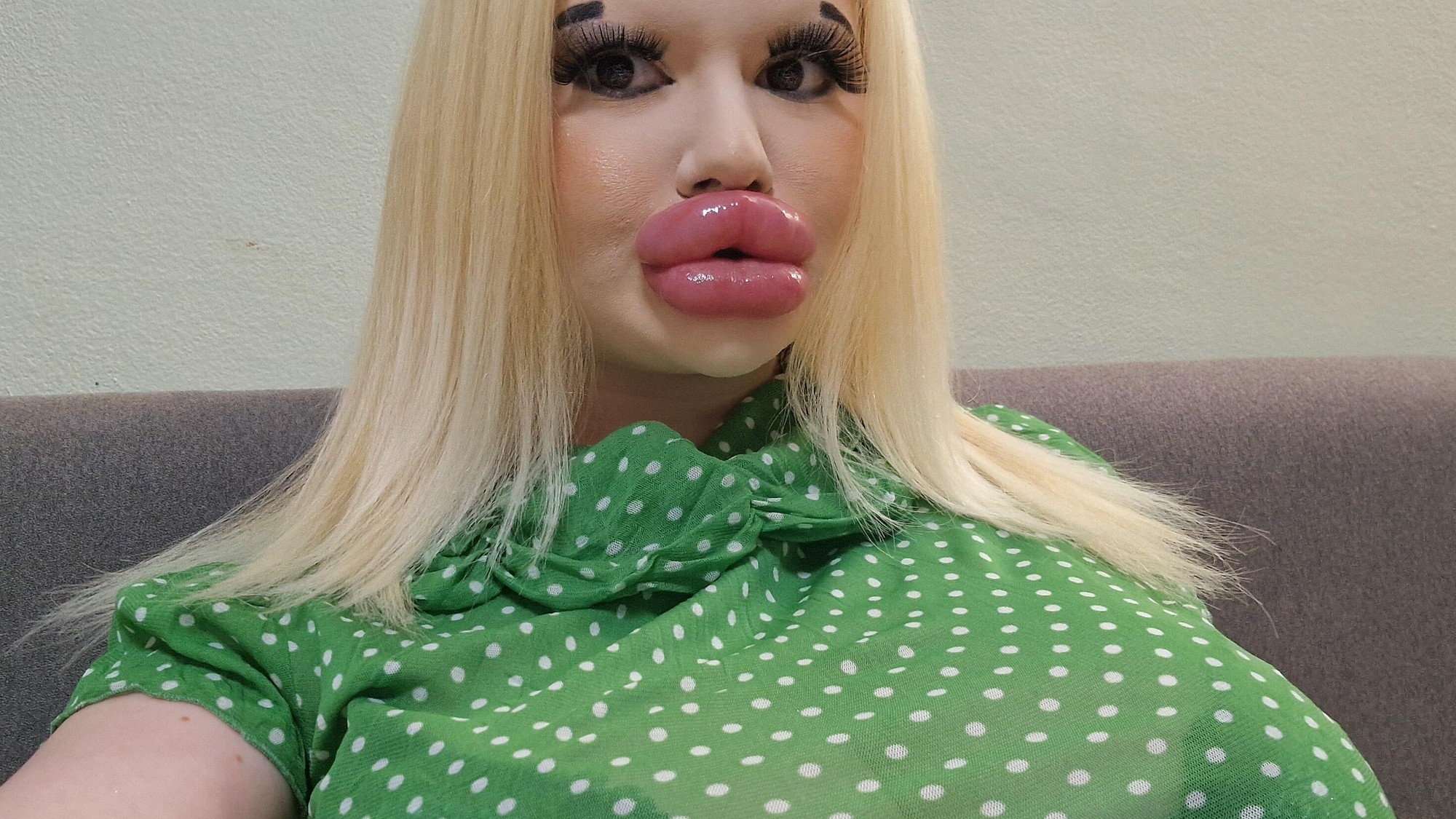 Andrea zainvestovala do svojich pier tisíce eur.