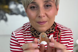 Dr Katarina Murgulj otkriva kad je pravo vreme za ŠIRENJE VILICA KOD DECE I ZAŠTO JE TO VAŽNO: "Može da se uradi samo u ODREĐENOM UZRASTU"