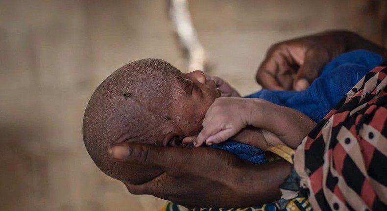 Malnourished children in Nigeria's IDP camps 