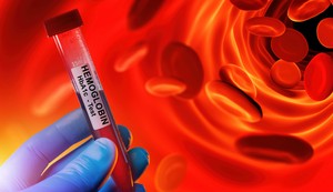 Hemoglobin je protein u crvenim krvnim zrncima koji prenosi kiseonik od pluća do ostatka tela