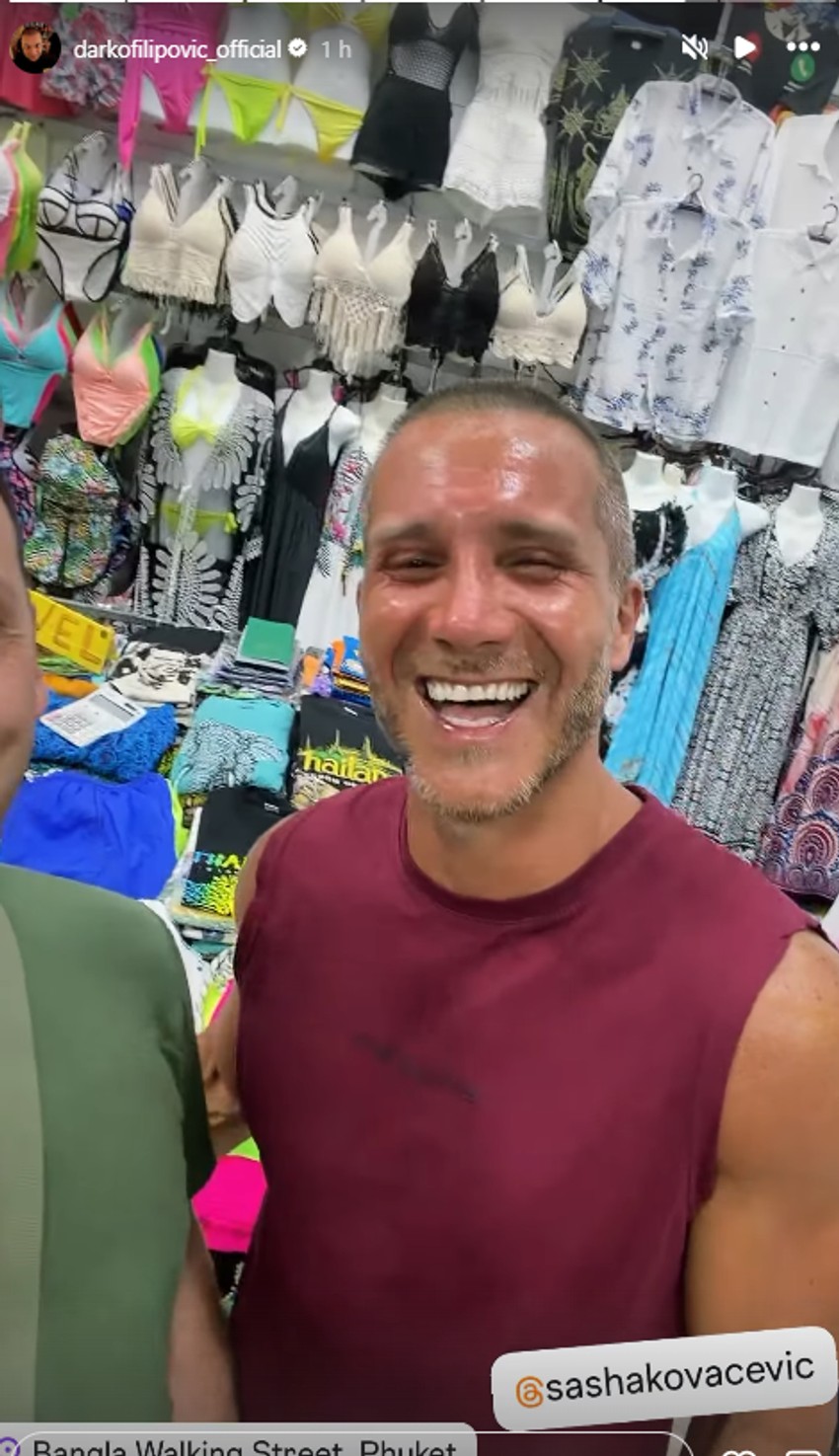 Saša Kovačević je skroz izgoreo na suncu