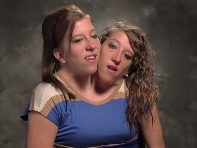 30002_295242-abby-and-brittany-hensel