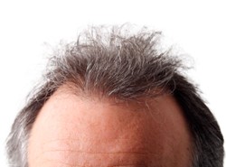 Koniec z siwizną! Jest lek, którzy przywróci włosom kolor