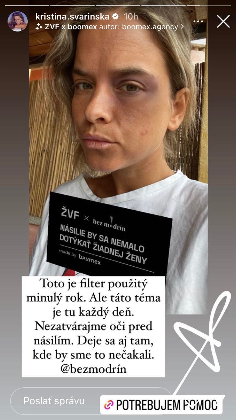 O násilí na ženách zdieľala príspevok aj vlani.