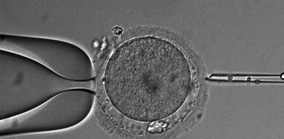 Przez rok zarejestrowano 701 ciąż z in vitro!