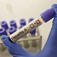 Hepatitisz A
