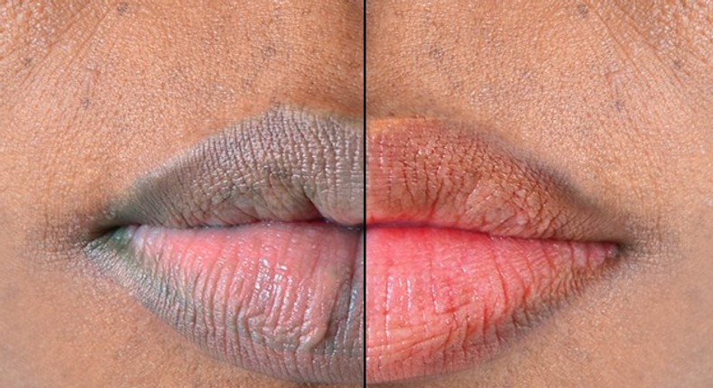 5 kitchen ingredients that you can use for pink lips [Medium]