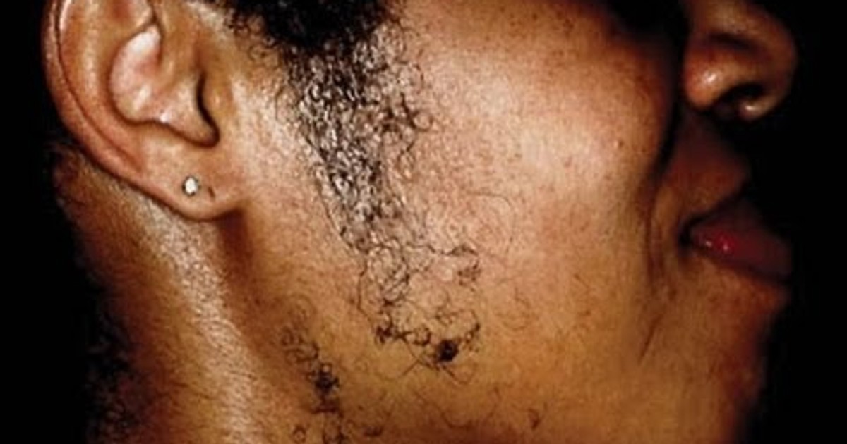 Ladies 4 easy homemade recipes to get rid of stubborn facial hair