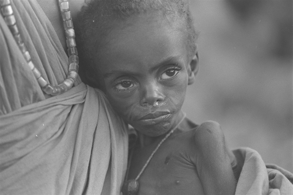 Wymień Trzy Przyrodnicze Przyczyny Głodu I Niedożywienia W Etiopii UNICEF: historyczne klęski głodu - Wiadomości